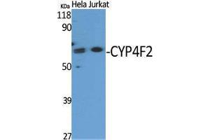 Western Blotting (WB) image for anti-Cytochrome P450, Family 4, Subfamily F, Polypeptide 2 (CYP4F2) (N-Term) antibody (ABIN3184201)