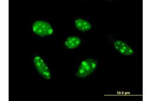 Immunofluorescence of purified MaxPab antibody to TSPYL1 on HeLa cell. (TSPYL1 Antikörper  (AA 1-438))