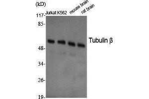 Western Blotting (WB) image for anti-Tubulin, beta (TUBB) (C-Term) antibody (ABIN3177834) (TUBB Antikörper  (C-Term))
