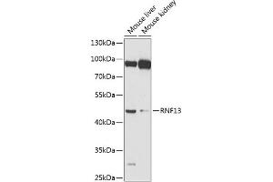 Western blot analysis of extracts of various cell lines, using RNF13 antibody (ABIN6128641, ABIN6147009, ABIN6147010 and ABIN6224394) at 1:1000 dilution. (RNF13 Antikörper  (AA 204-381))