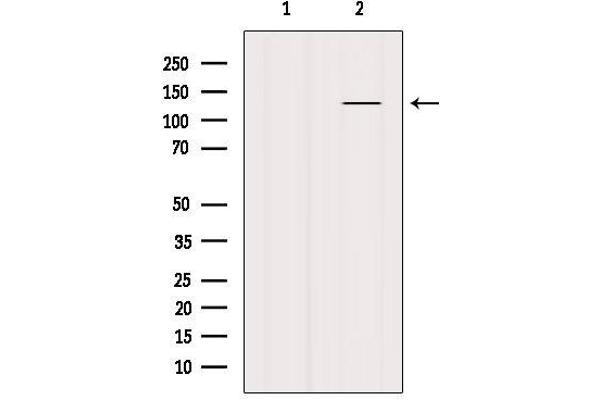SMC3 Antikörper  (C-Term)