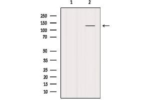 Western blot analysis of extracts from Mouse lung, using SMC3 Antibody. (SMC3 Antikörper  (C-Term))