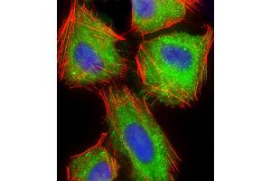 Immunofluorescence (IF) image for anti-Actin Related Protein 2/3 Complex, Subunit 5, 16kDa (ARPC5) (AA 67-101) antibody (ABIN6242714)