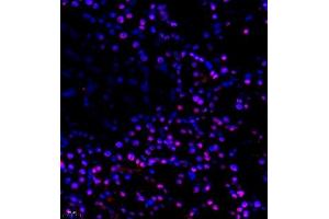 Immunofluorescence (Paraffin-embedded Sections) (IF (p)) image for anti-Cbp/p300-Interacting Transactivator, with Glu/Asp-Rich Carboxy-terminal Domain, 4 (CITED4) antibody (ABIN7073356)