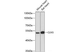 Western blot analysis of extracts of various cell lines using CLN5 Polyclonal Antibody at dilution of 1:3000. (CLN5 Antikörper)
