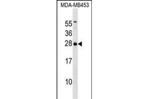 IT Antibody (C-term) (ABIN1536735 and ABIN2850350) western blot analysis in MDA-M cell line lysates (35 μg/lane).