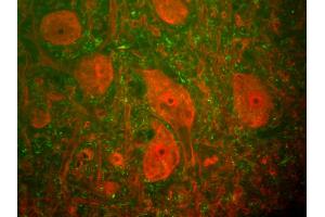 Rat spinal cord stained with anti-UCHL1(red) and anti-neurofilament NF-H antibody (1451-NFH)(green). (UCHL1 Antikörper)