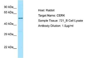 Host: Rabbit Target Name: CERK Sample Type: 721_B Whole Cell lysates Antibody Dilution: 1. (CERK Antikörper  (C-Term))