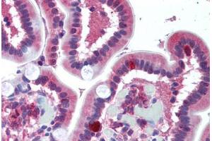 Human Small Intestine (formalin-fixed, paraffin-embedded) stained with FPR1 antibody ABIN297066 at 10 ug/ml followed by biotinylated goat anti-rabbit IgG secondary antibody ABIN481713, alkaline phosphatase-streptavidin and chromogen.