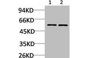 CACNB3 Antikörper