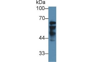 Western blot analysis of Human Liver lysate, using Human IGF2BP2 Antibody (3 µg/ml) and HRP-conjugated Goat Anti-Rabbit antibody (