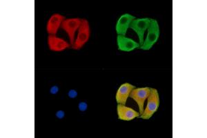ABIN7095772 and ABIN7099834 staining Hela cells by IF/ICC.