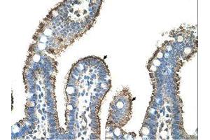 Image no. 1 for anti-Matrix Metallopeptidase 1 (Interstitial Collagenase) (MMP1) (AA 21-70) antibody (ABIN203491) (MMP1 Antikörper  (AA 21-70))