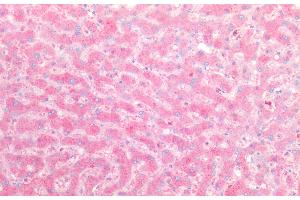 Immunohistochemistry of paraffin-embedded Human liver tissue using ORM2 Polyclonal Antibody at dilution of 1:100.