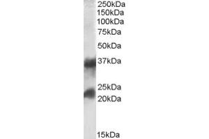 Image no. 1 for anti-Clathrin, Light Chain A (CLTA) (Internal Region), (Light Chain) antibody (ABIN375031) (CLTA Antikörper  (Internal Region, Light Chain))