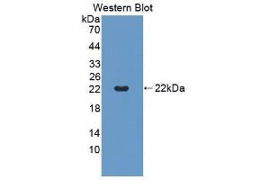 Western blot analysis of the recombinant protein. (CD40 Antikörper  (AA 26-193))