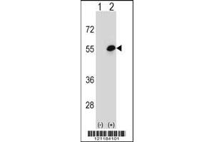 Western blot analysis of COCH using rabbit polyclonal COCH Antibody using 293 cell lysates (2 ug/lane) either nontransfected (Lane 1) or transiently transfected (Lane 2) with the COCH gene.