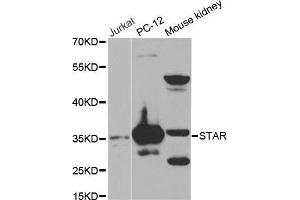 Western blot analysis of extracts of various cell lines, using STAR antibody. (STAR Antikörper  (AA 64-285))