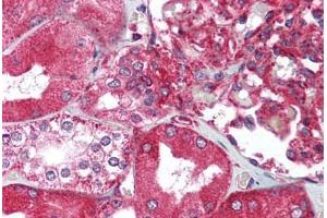 Human Kidney (formalin-fixed, paraffin-embedded) stained with XBP1 antibody ABIN214020 at 5 ug/ml followed by biotinylated goat anti-rabbit IgG secondary antibody ABIN481713, alkaline phosphatase-streptavidin and chromogen. (XBP1 Antikörper  (C-Term))