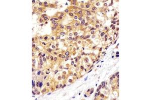 Immunohistochemistry (Paraffin-embedded Sections) (IHC (p)) image for anti-Valosin Containing Protein (VCP) antibody (ABIN6242610)