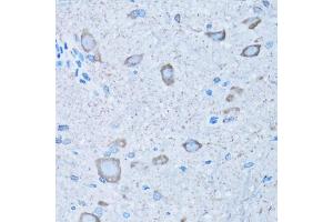 Immunohistochemistry of paraffin-embedded mouse spinal cord using NNMT antibody (ABIN5974021) at dilution of 1/100 (40x lens). (NNMT Antikörper)