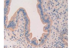Immunohistochemistry (IHC) image for anti-Laminin, alpha 4 (LAMa4) (AA 457-630) antibody (ABIN7438160)