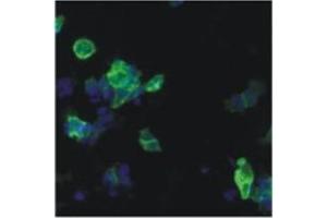 anti-Human Immunodeficiency Virus Type 1 (HIV-1) antibody