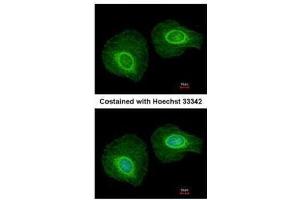 ICC/IF Image Immunofluorescence analysis of methanol-fixed HeLa, using Cytokeratin 34, antibody at 1:200 dilution. (Keratin 34 Antikörper)