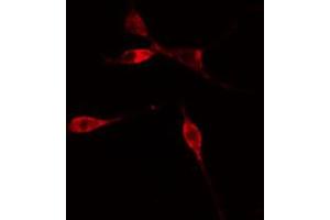 Immunofluorescence (fixed cells) (IF/ICC) image for anti-Ribosomal Protein L36 (RPL36) (C-Term) antibody (ABIN6257638)