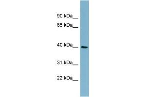 WB Suggested Anti-MOS  Antibody Titration: 0. (MOS Antikörper  (Middle Region))