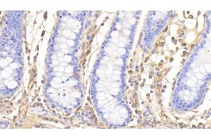 Immunohistochemistry (IHC) image for anti-Glycated Hemoglobin HbA1c (HbA1c) antibody (ABIN7431281)