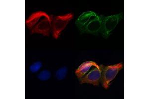 ABIN6262625 and ABIN6268687 staining Hela by IF/ICC.