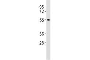 Western blot testing of CB1 antibody at 1:2000 dilution + A431 lysate (CNR1 Antikörper  (AA 433-468))