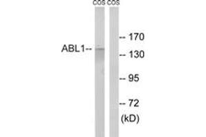 Western blot analysis of extracts from COS7 cells, treated with calyculinA 50ng/ml 30', using ABL1 (Ab-735) Antibody. (ABL1 Antikörper  (AA 701-750))