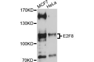 Western blot analysis of extracts of various cell lines, using E2F8 antibody (ABIN5970483) at 1/1000 dilution. (E2F8 Antikörper)