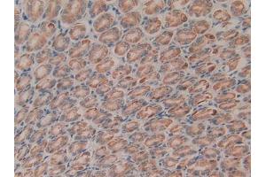IHC-P analysis of Rat Liver Tissue, with DAB staining. (CTGF Antikörper)
