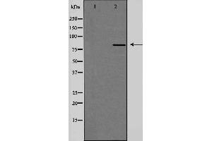 Western blot analysis of extracts from HeLa cells, using PMS2 antibody. (PMS2 Antikörper  (C-Term))