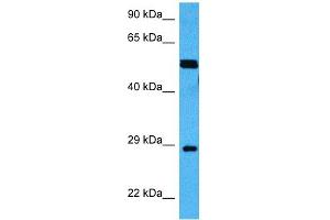 Western Blotting (WB) image for anti-Methyl CpG Binding Protein 2 (MECP2) (Middle Region) antibody (ABIN2780632)