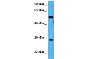 Host:  Mouse  Target Name:  MECP2  Sample Tissue:  Mouse Skeletal Muscle  Antibody Dilution:  1ug/ml (MECP2 Antikörper  (Middle Region))