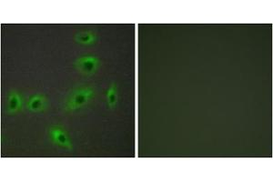 Immunofluorescence analysis of HUVEC cells, using BAX antibody. (BAX Antikörper  (Internal Region))