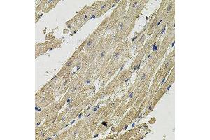 Immunohistochemistry of paraffin-embedded rat heart using SMN2 antibody. (SMN2 Antikörper  (AA 1-197))