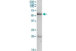 PDE9A MaxPab rabbit polyclonal antibody. (PDE9A Antikörper  (AA 1-533))