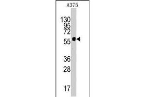 Western blot analysis of KREMEN1 polyclonal antibody  in A-375 cell line lysates (35 ug/lane). (KREMEN1 Antikörper  (N-Term))