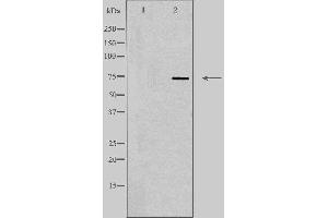 Western blot analysis of extracts from 293 cells, using SLC5A2 antibody.