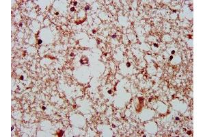 IHC image of ABIN7154521 diluted at 1:400 and staining in paraffin-embedded human brain tissue performed on a Leica BondTM system. (GHITM Antikörper  (AA 293-345))
