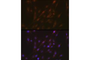 Immunofluorescence analysis of C6 cells using ASC/TMS1 Rabbit pAb (ABIN7269756) at dilution of 1:100 (40x lens). (PYCARD Antikörper)