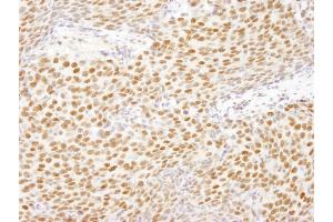anti-Heterogeneous Nuclear Ribonucleoprotein U-Like 1 (HNRNPUL1) (AA 50-100) antibody