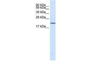 Western Blot showing SCN3B antibody used at a concentration of 1-2 ug/ml to detect its target protein. (SCN3B Antikörper  (N-Term))