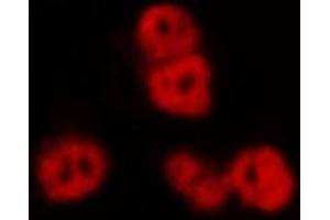 Immunofluorescence (fixed cells) (IF/ICC) image for anti-Nuclear Factor of kappa Light Polypeptide Gene Enhancer in B-Cells 1 (NFKB1) (C-Term) antibody (ABIN6263615)