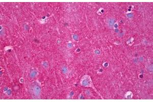 Anti-NDRG4 antibody IHC staining of human brain, cortex neuropil. (NDRG4 Antikörper  (AA 1-340))